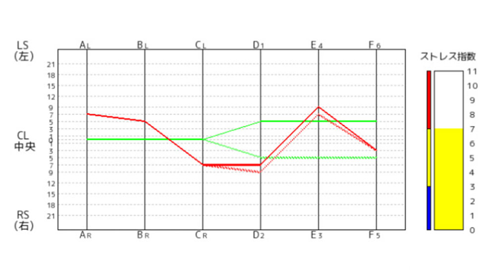 アローバランスグラフ